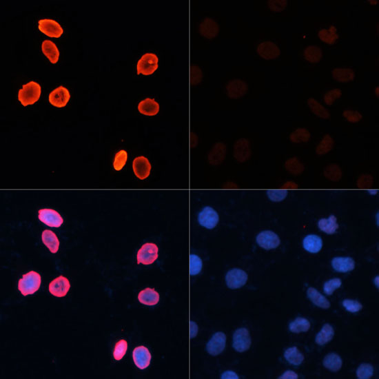 Acetyl-Histone H3-K56 pAb