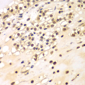 BCAS3 Rabbit Polyclonal Antibody