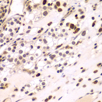 CEBPG Rabbit Polyclonal Antibody