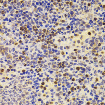 PRDM5 Rabbit Polyclonal Antibody