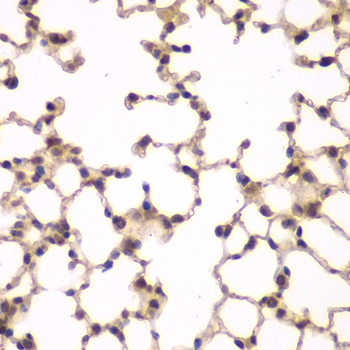 PIP4K2A Rabbit Polyclonal Antibody