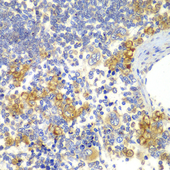 NOTCH1 Polyclonal Antibody