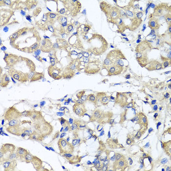 BCS1L Polyclonal Antibody