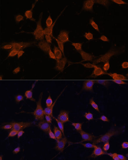 MAP2K3 Polyclonal Antibody