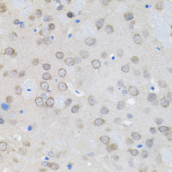 UBE2A Rabbit Polyclonal Antibody