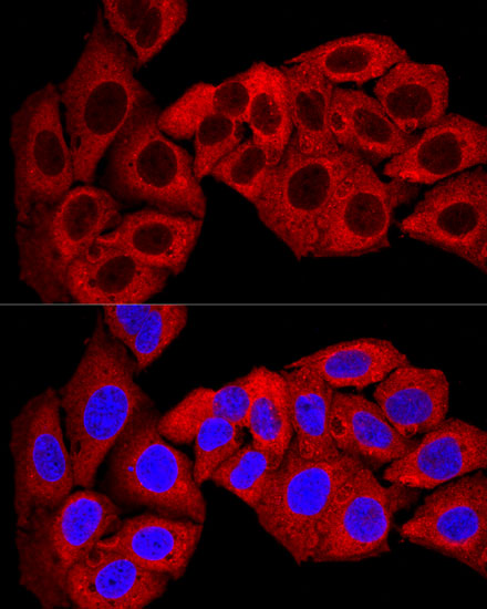 SQSTM1 / p62 Polyclonal Antibody