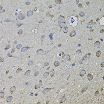 CKAP4 Rabbit Polyclonal Antibody