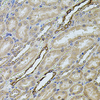 CHRFAM7A Rabbit Polyclonal Antibody