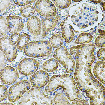 CDH16 Rabbit Polyclonal Antibody