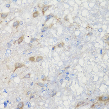 CHIC2 Polyclonal Antibody