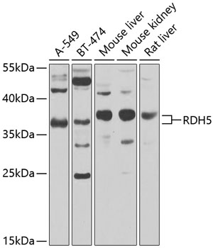 RDH5 Polyclonal Antibody