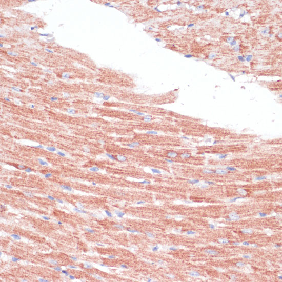 FZD4 Rabbit Polyclonal Antibody