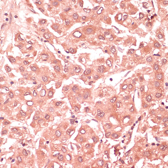 RNF5 Rabbit Polyclonal Antibody