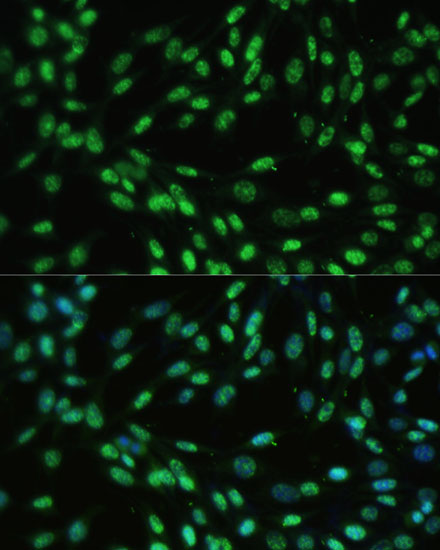 DDX39B Rabbit Polyclonal Antibody
