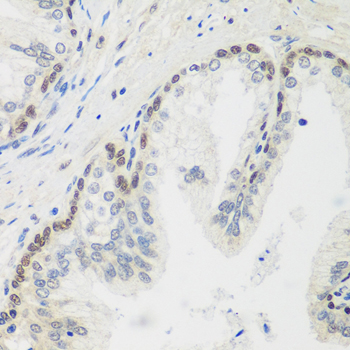 MDC1 Rabbit Polyclonal Antibody