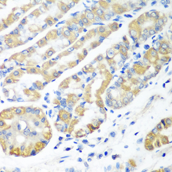 MSRB2 Polyclonal Antibody