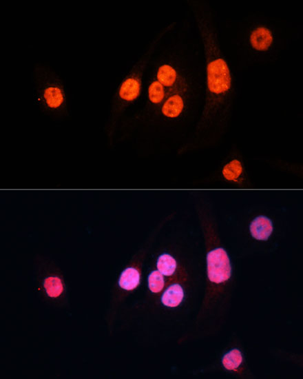 METTL3 Polyclonal Antibody