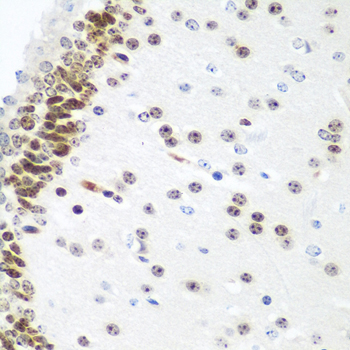UBE2U Rabbit Polyclonal Antibody