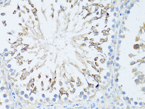 TEFM Polyclonal Antibody