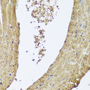 PIK3C2A Rabbit Polyclonal Antibody