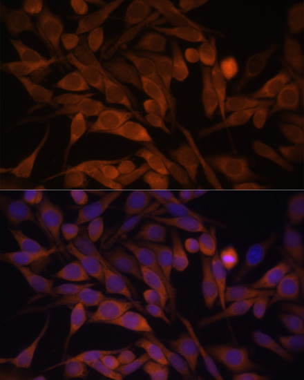 CACYBP Rabbit Polyclonal Antibody