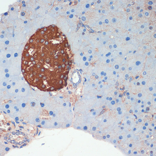 SST Rabbit Polyclonal Antibody