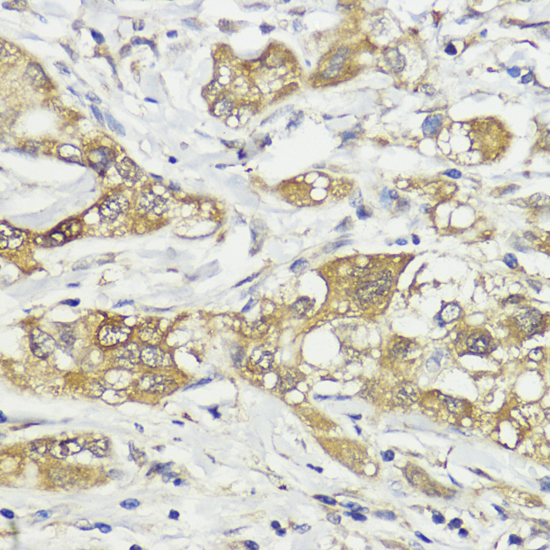HACE1 Rabbit Polyclonal Antibody