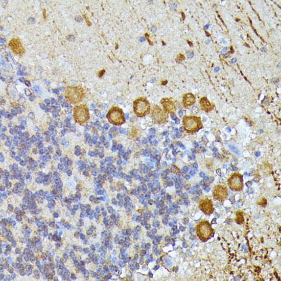 ELP3 Polyclonal Antibody