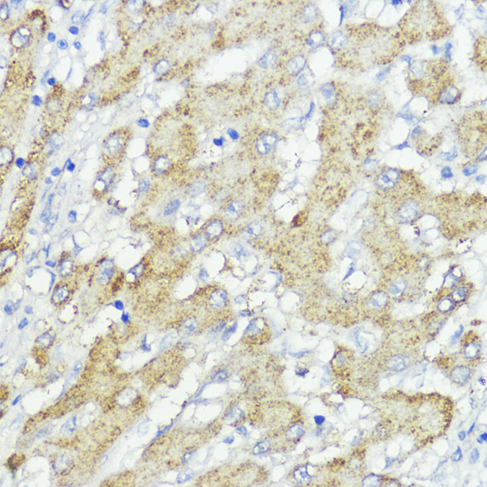 SOCS6 Rabbit Polyclonal Antibody