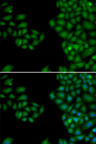 NEFL antibody