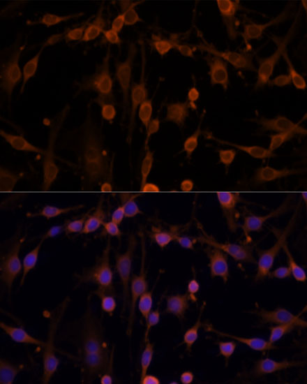 NME1 Antibody