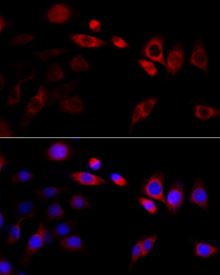 HSP90B1 antibody