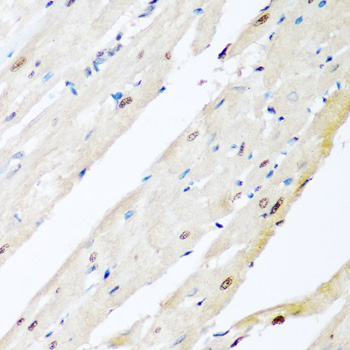 VCP antibody