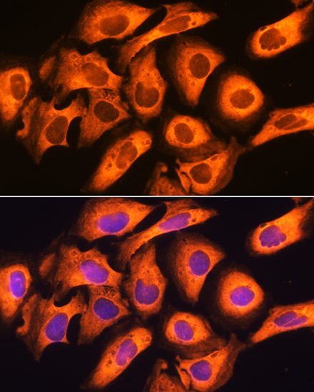 RIG-I / DDX58 Polyclonal Antibody