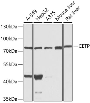 CETP antibody