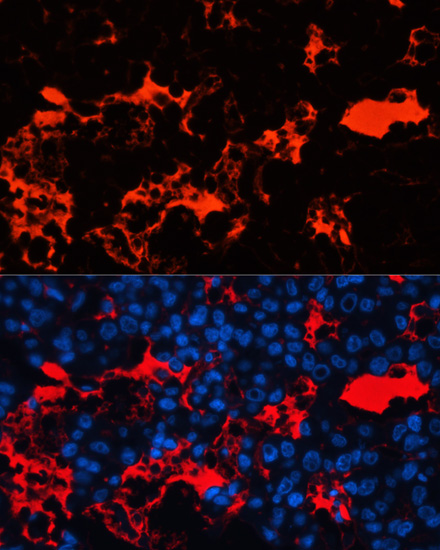 ALB antibody