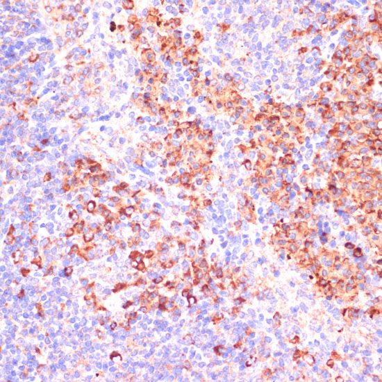 MZB1 Polyclonal Antibody
