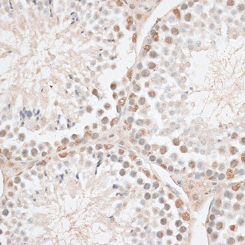 HMGN1 Polyclonal Antibody