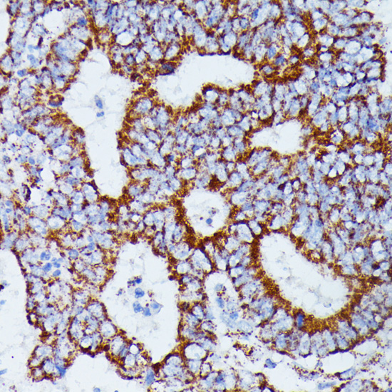 IDH3A Polyclonal Antibody