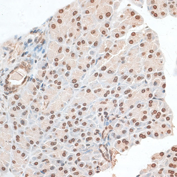 ZNF177 Polyclonal Antibody