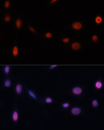 CDKN1A Antibody