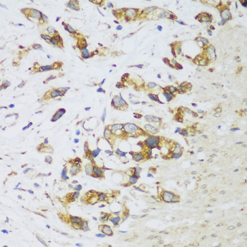 ERLIN1 Polyclonal Antibody
