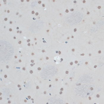 ZNF433 Polyclonal Antibody