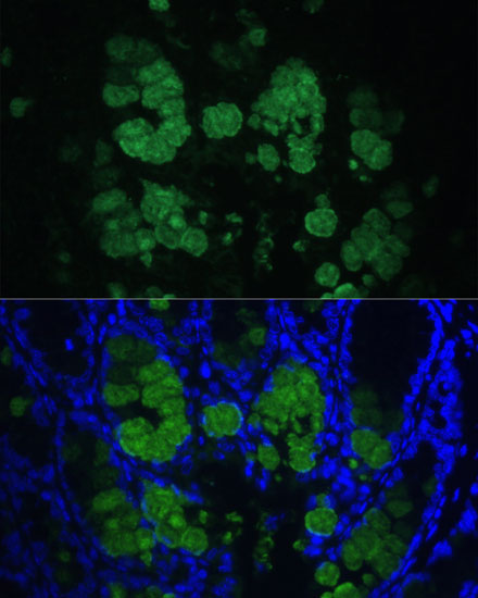 CLCA1 Polyclonal Antibody