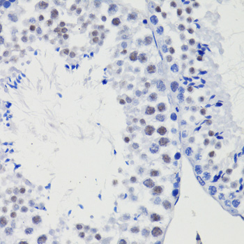 TET1 antibody