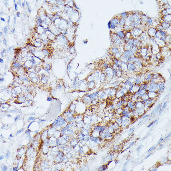 MANBA Polyclonal Antibody