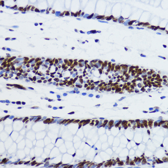 Acetyl-Histone H2B-K12 pAb