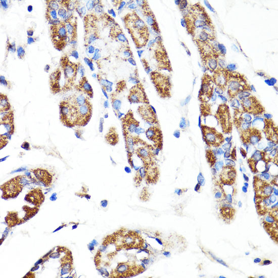 RNF149 Polyclonal Antibody