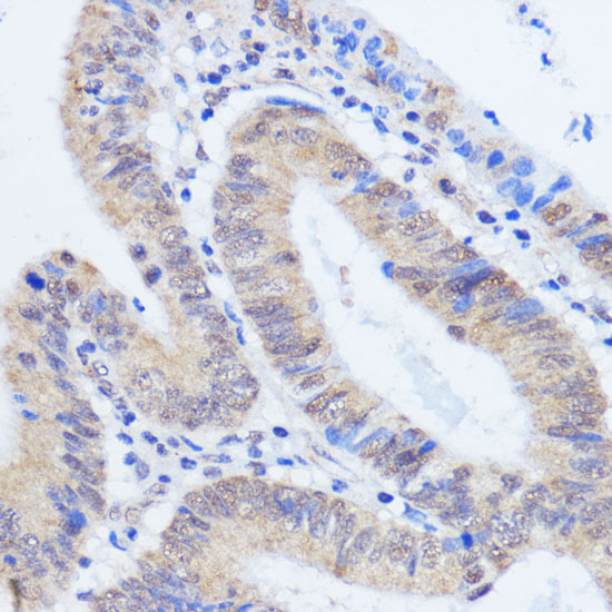 RBM39 Polyclonal Antibody