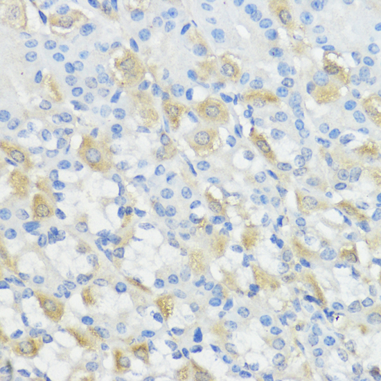 GPX2 Polyclonal Antibody